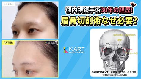 眉骨が出ているのは男顔？！自力で改善する方法はある？